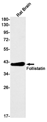 Follistatin Rabbit mAb