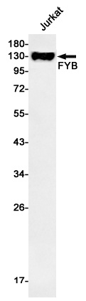 FYB Rabbit mAb