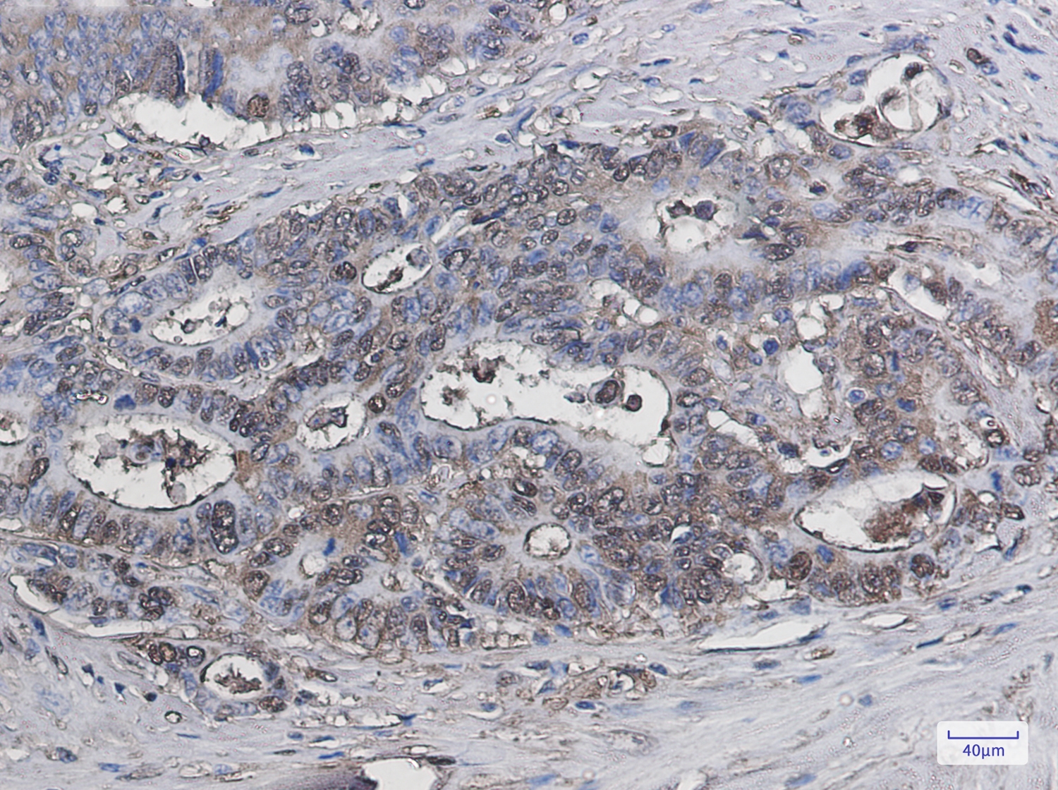 Galectin 3 Rabbit mAb