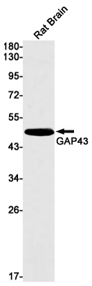 GAP43 Rabbit mAb