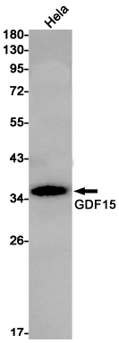 GDF15 Rabbit mAb