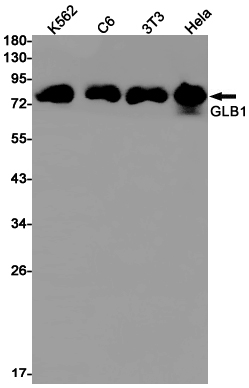 GLB1 Rabbit mAb