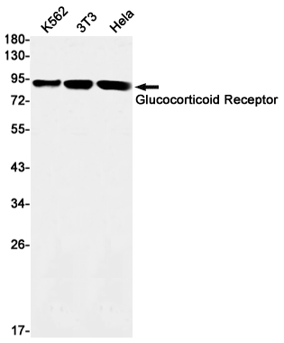 Glucocorticoid Receptor Rabbit mAb