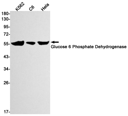 Glucose 6 Phosphate Dehydrogenase Rabbit mAb