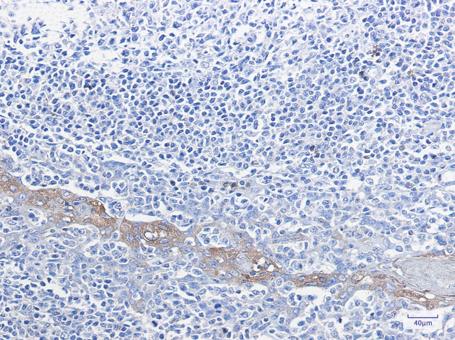 Glucose 6 Phosphate Dehydrogenase Rabbit mAb