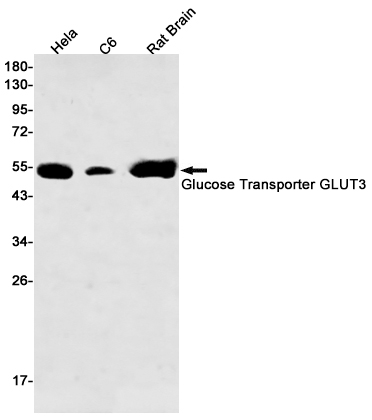 Glucose Transporter GLUT3 Rabbit mAb