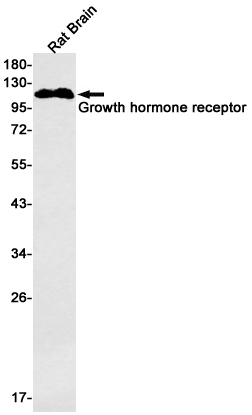 Growth Hormone Receptor Rabbit mAb