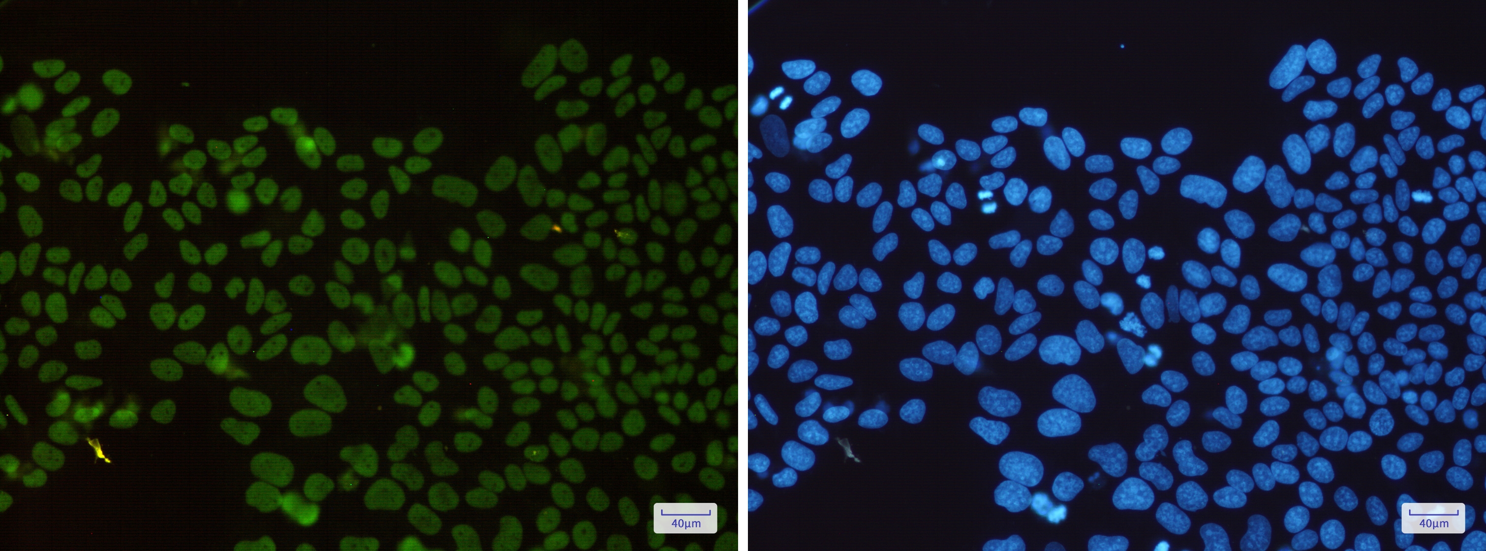 HDAC2 Rabbit mAb