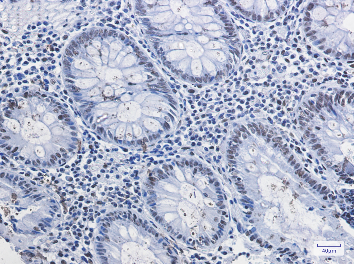 HDAC2 Rabbit mAb