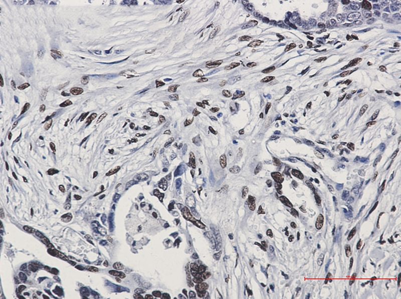 Histone H1.0 Rabbit mAb