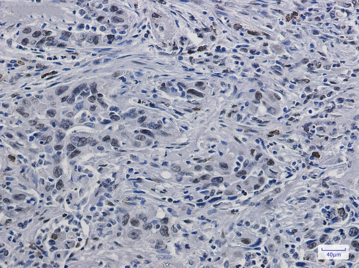 Histone H3.3 Rabbit mAb