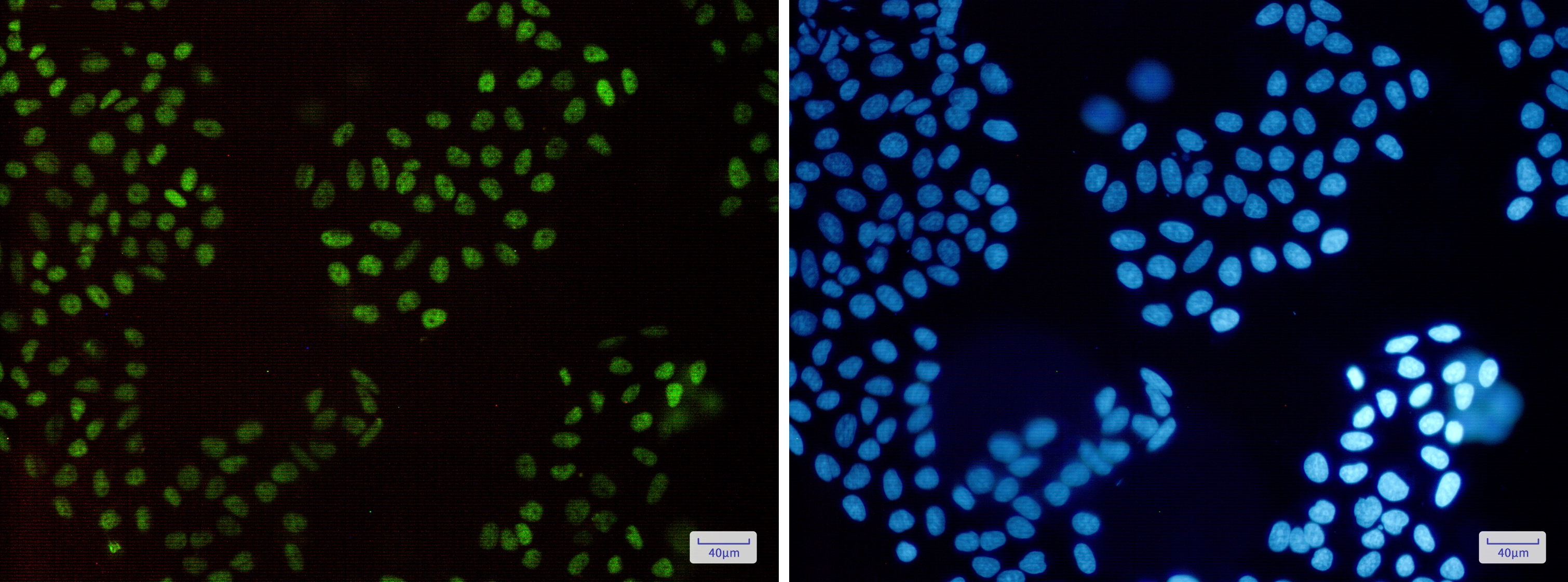 HLTF Rabbit mAb