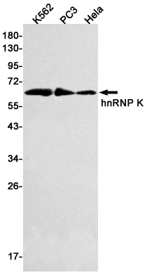 hnRNP K Rabbit mAb