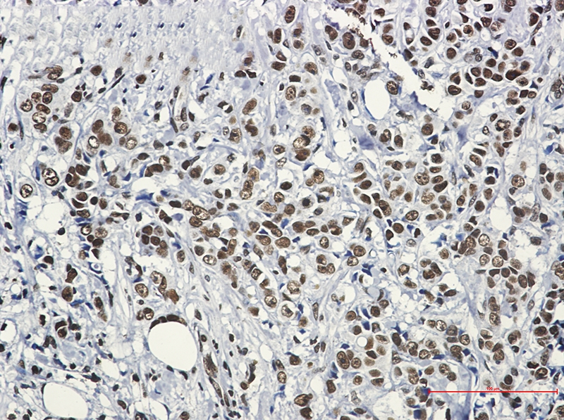 Hsf1 Rabbit mAb