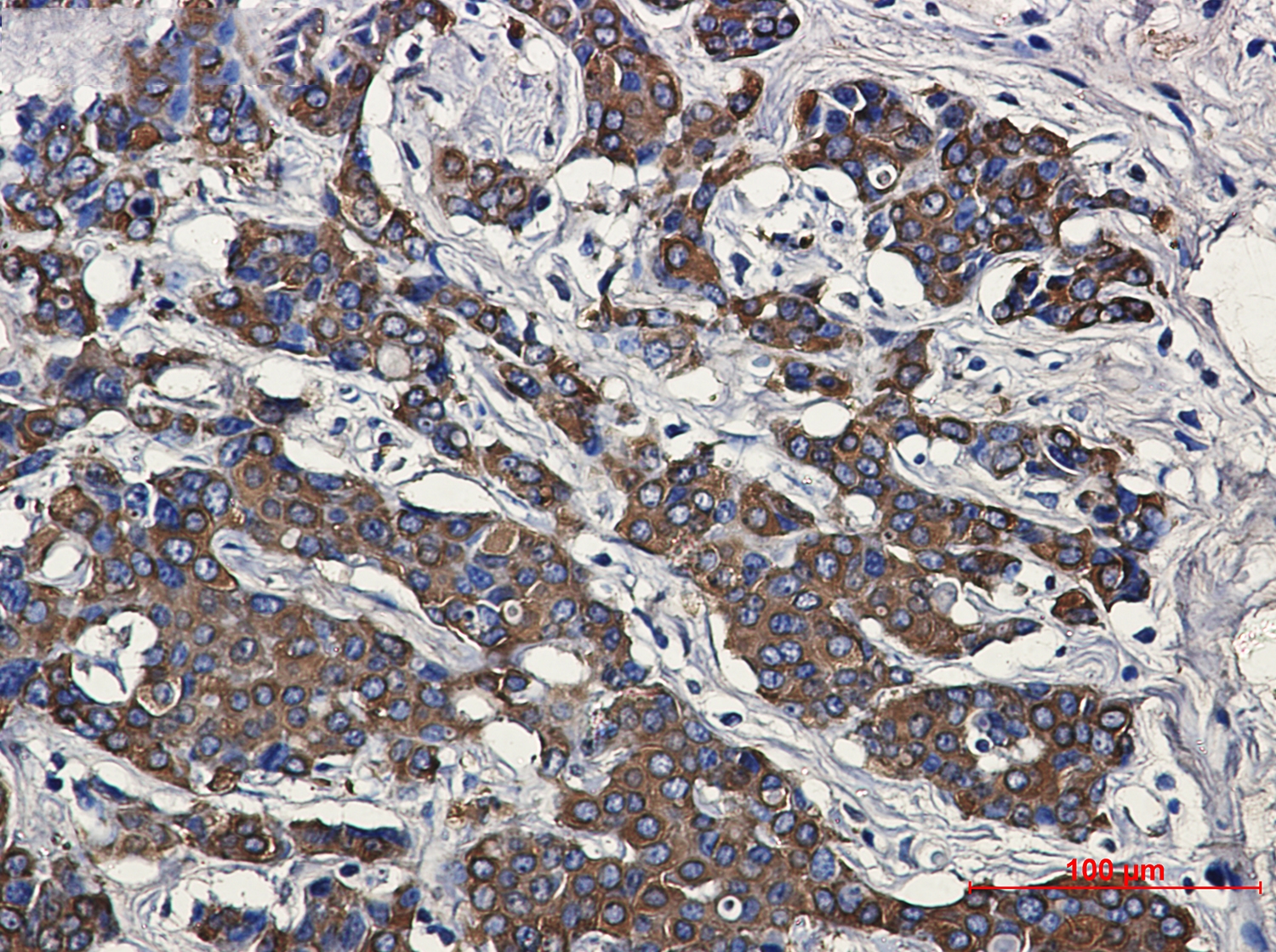 Hsp27 Rabbit mAb