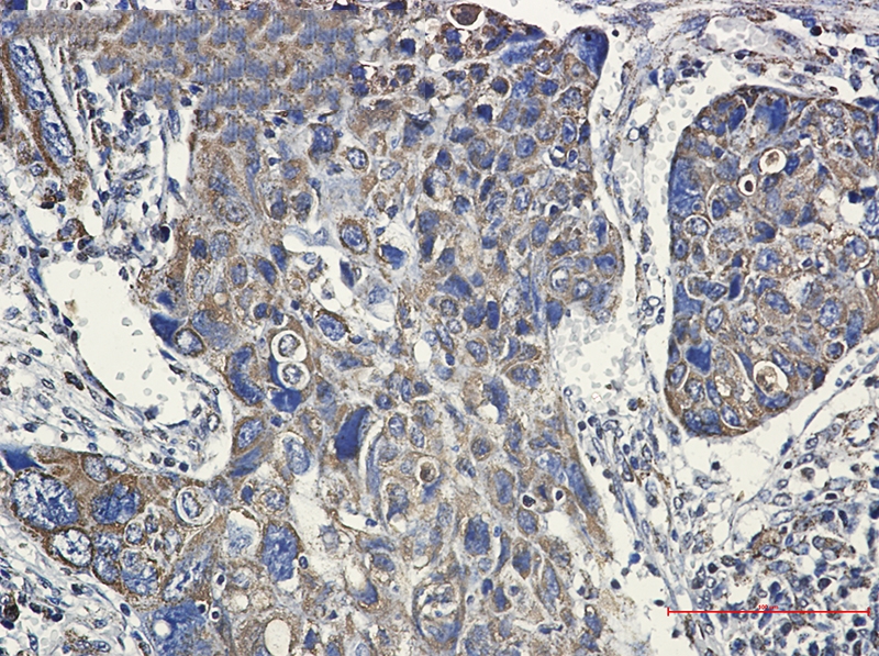 Hsp60 Rabbit mAb