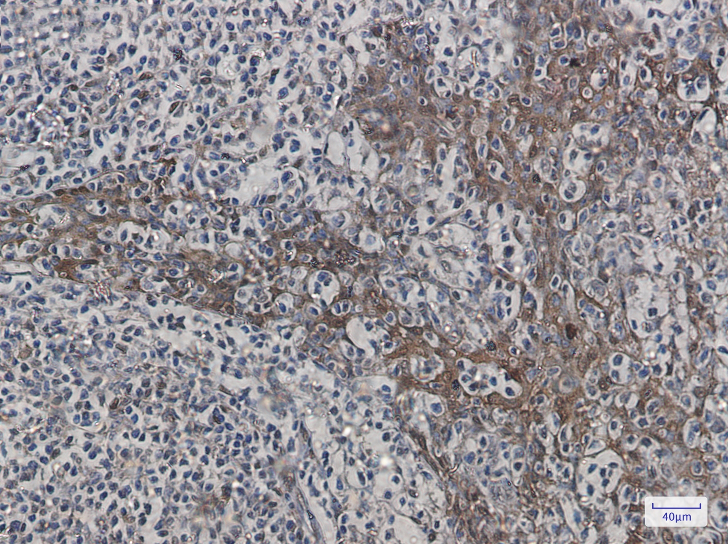 Hsp70 1B Rabbit mAb