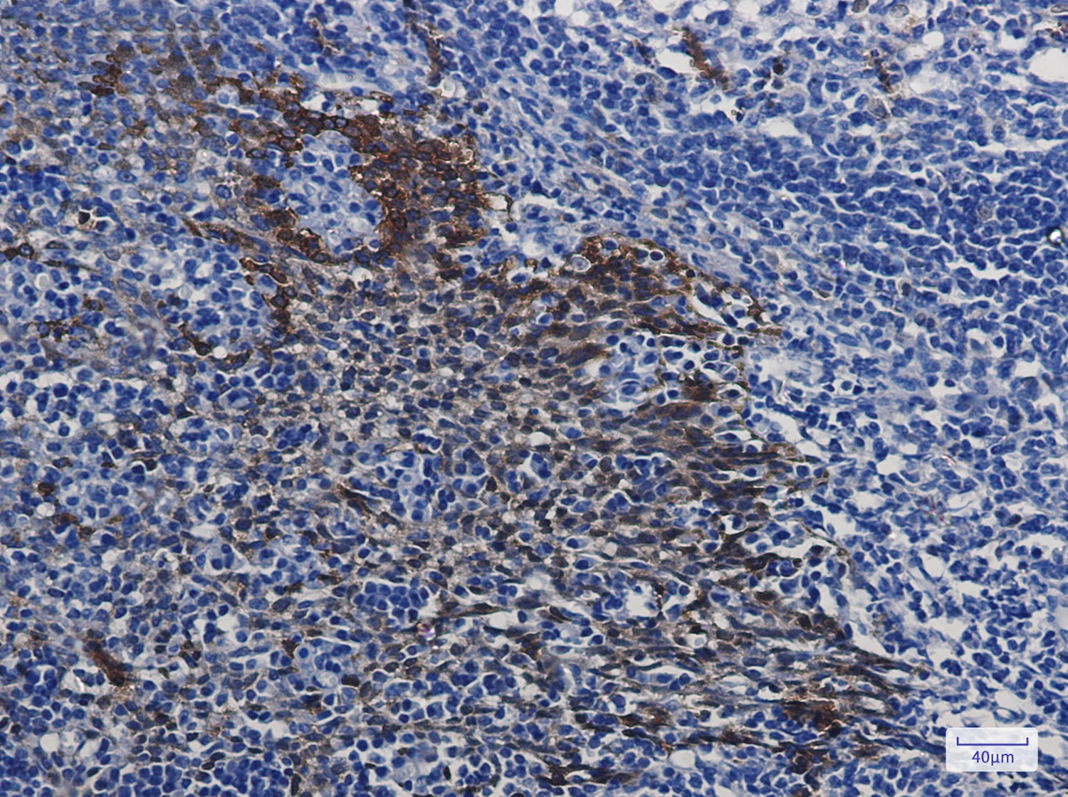 Hsp70 1A Rabbit mAb