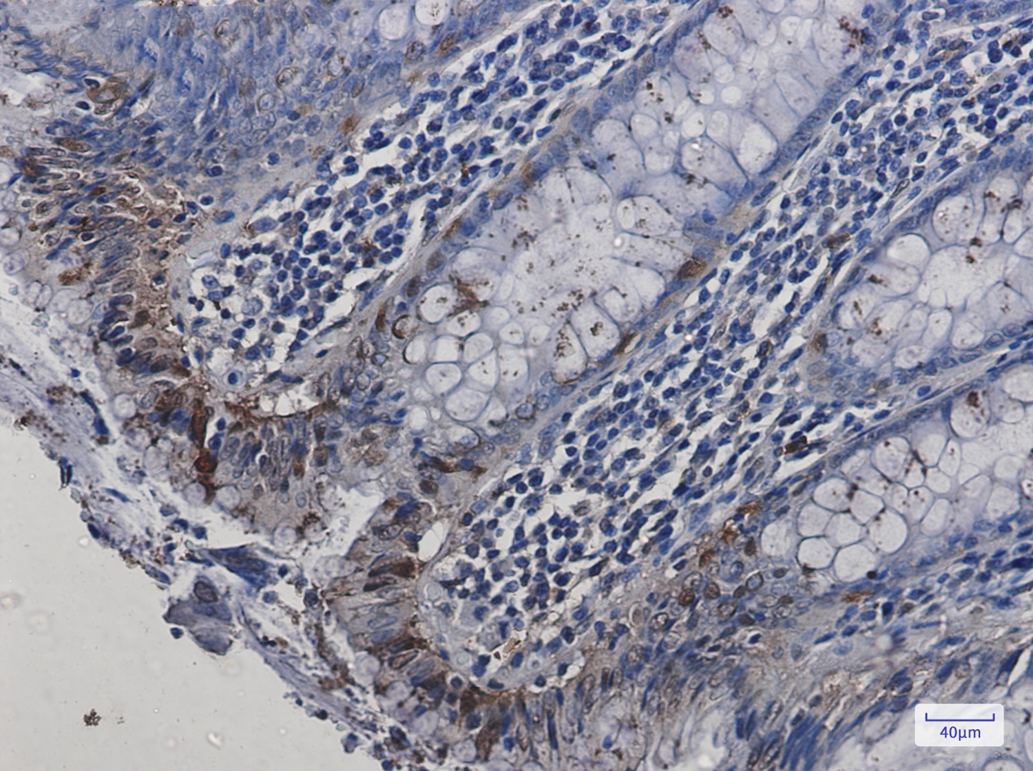 HspA2 Rabbit mAb