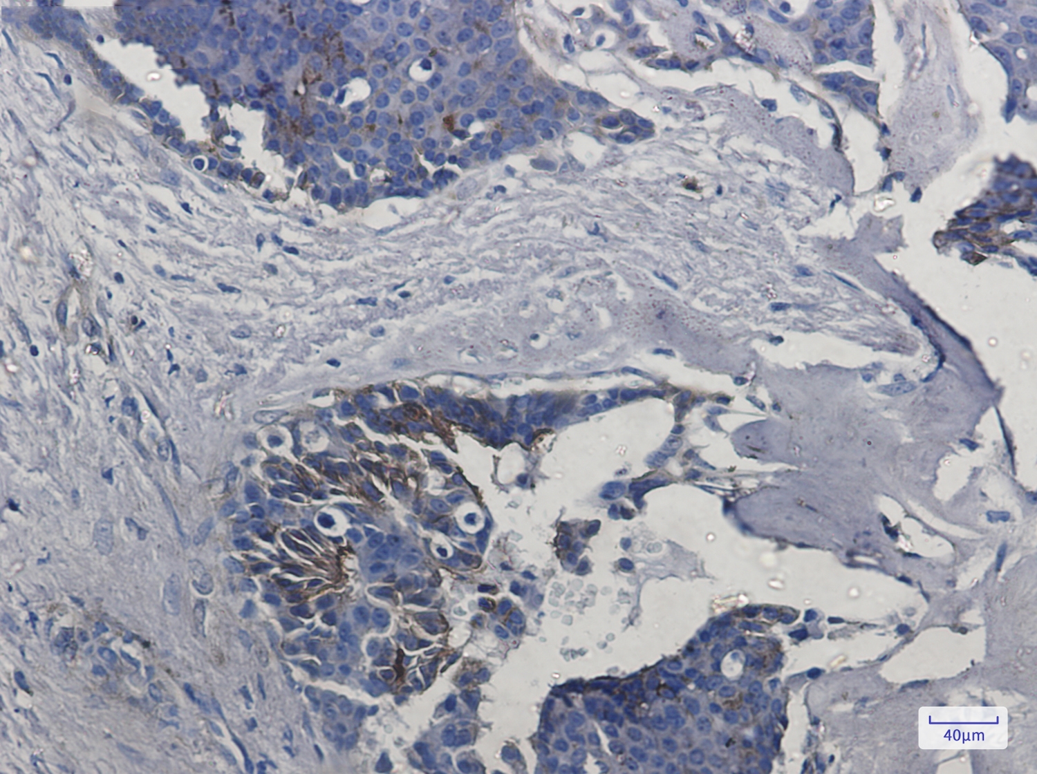 IFITM1 Rabbit mAb