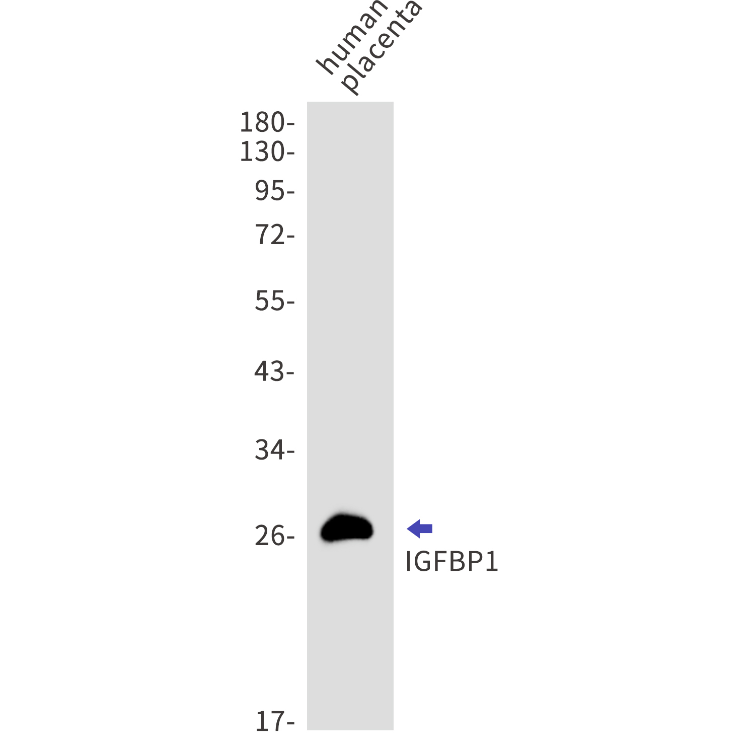 IGFBP1 Rabbit mAb