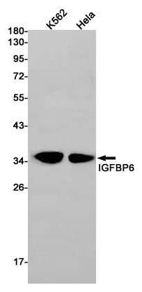 IGFBP6 Rabbit mAb