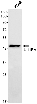 IL 11 Receptor alpha Rabbit mAb