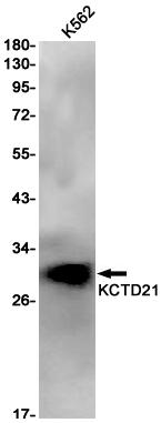 KCTD21 Rabbit mAb