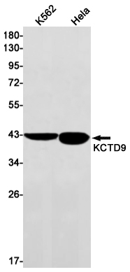 KCTD9 Rabbit mAb