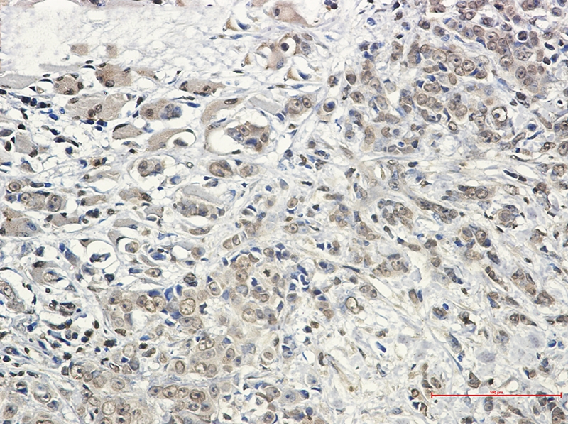 KIF5B Rabbit mAb