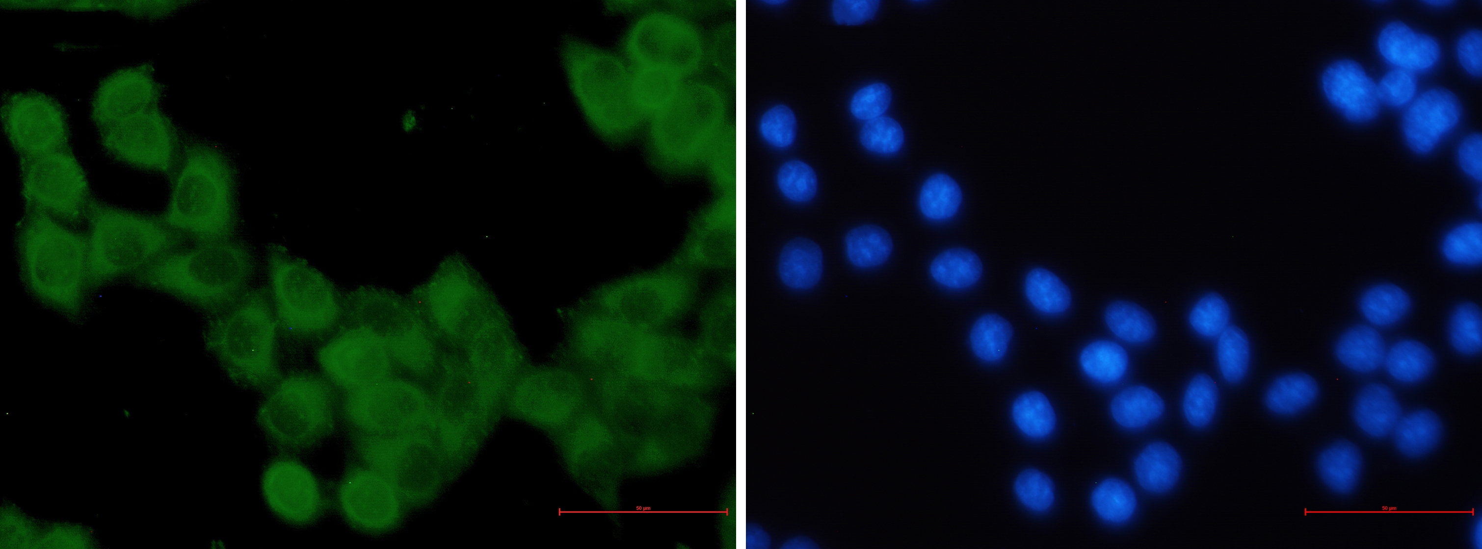 KIF5B Rabbit mAb