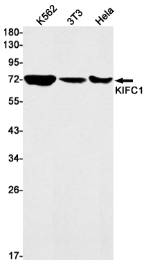 KIFC1 Rabbit mAb