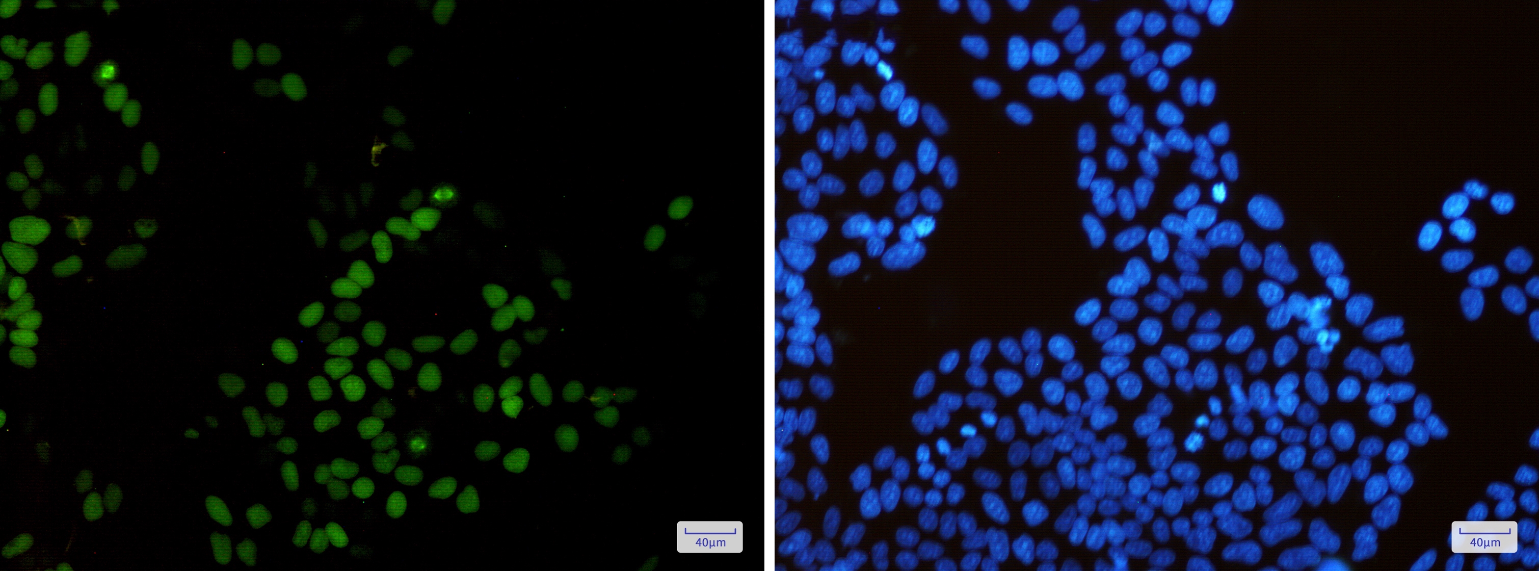 KIFC1 Rabbit mAb