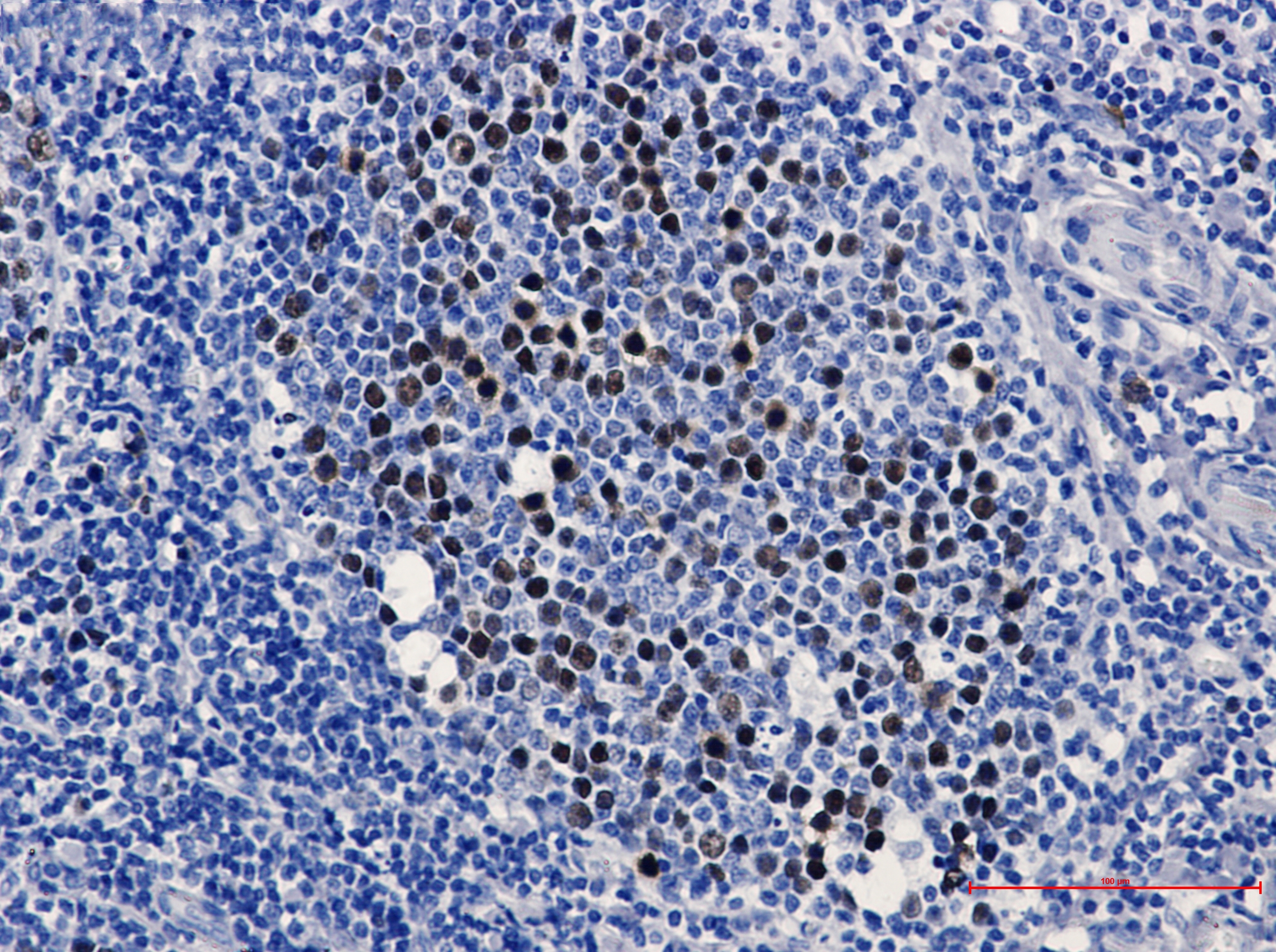 KIFC1 Rabbit mAb