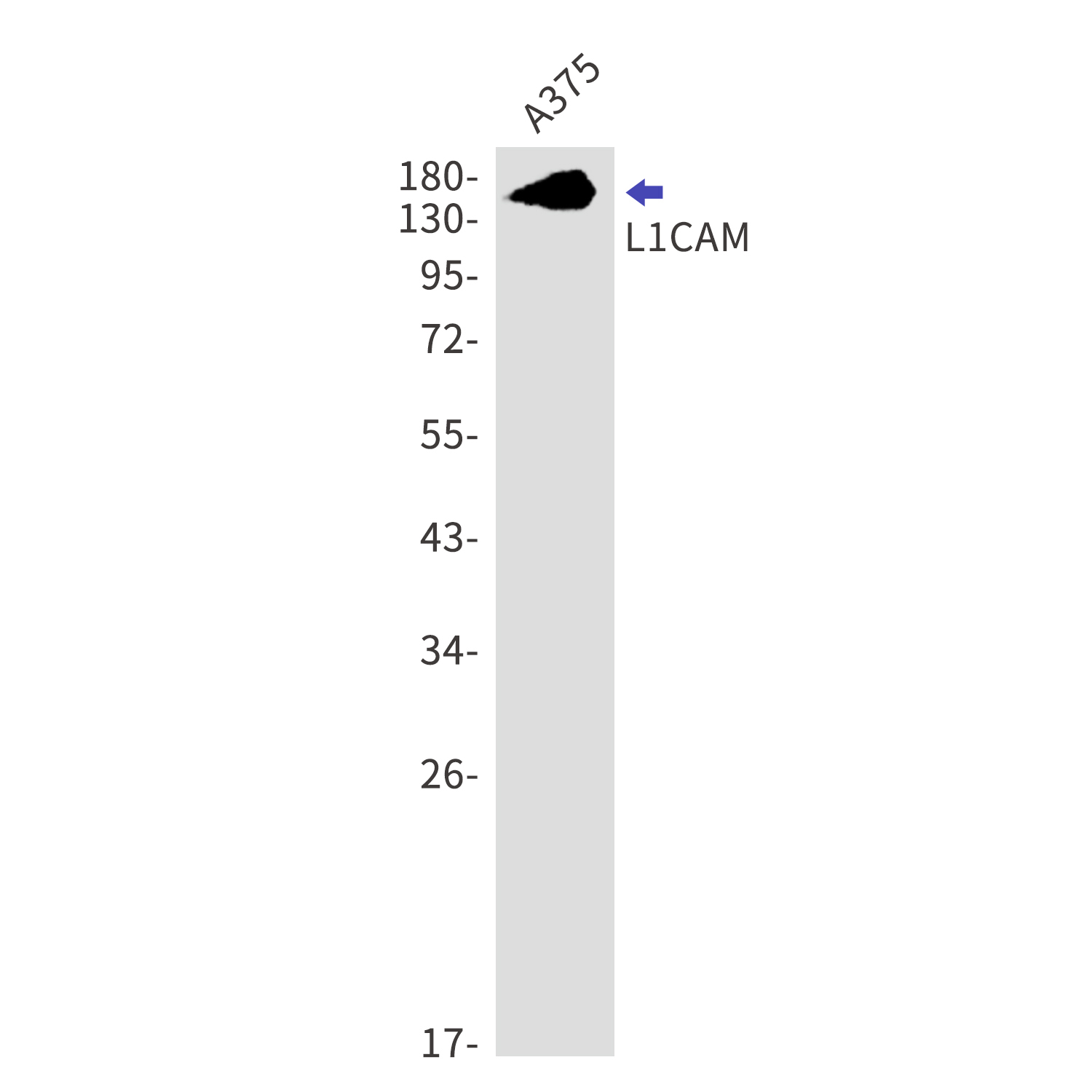 L1CAM Rabbit mAb