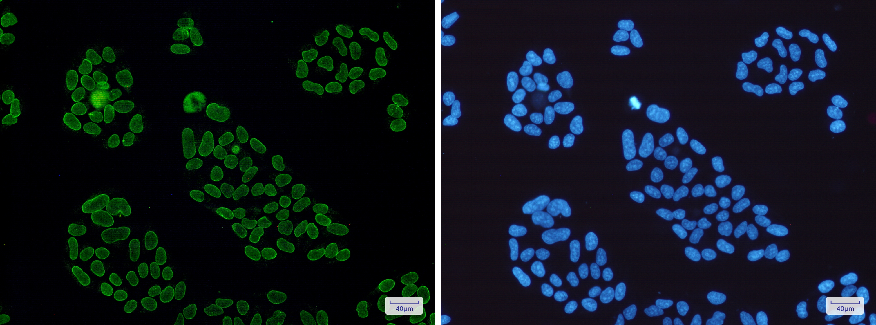 Lamin A/C Rabbit mAb