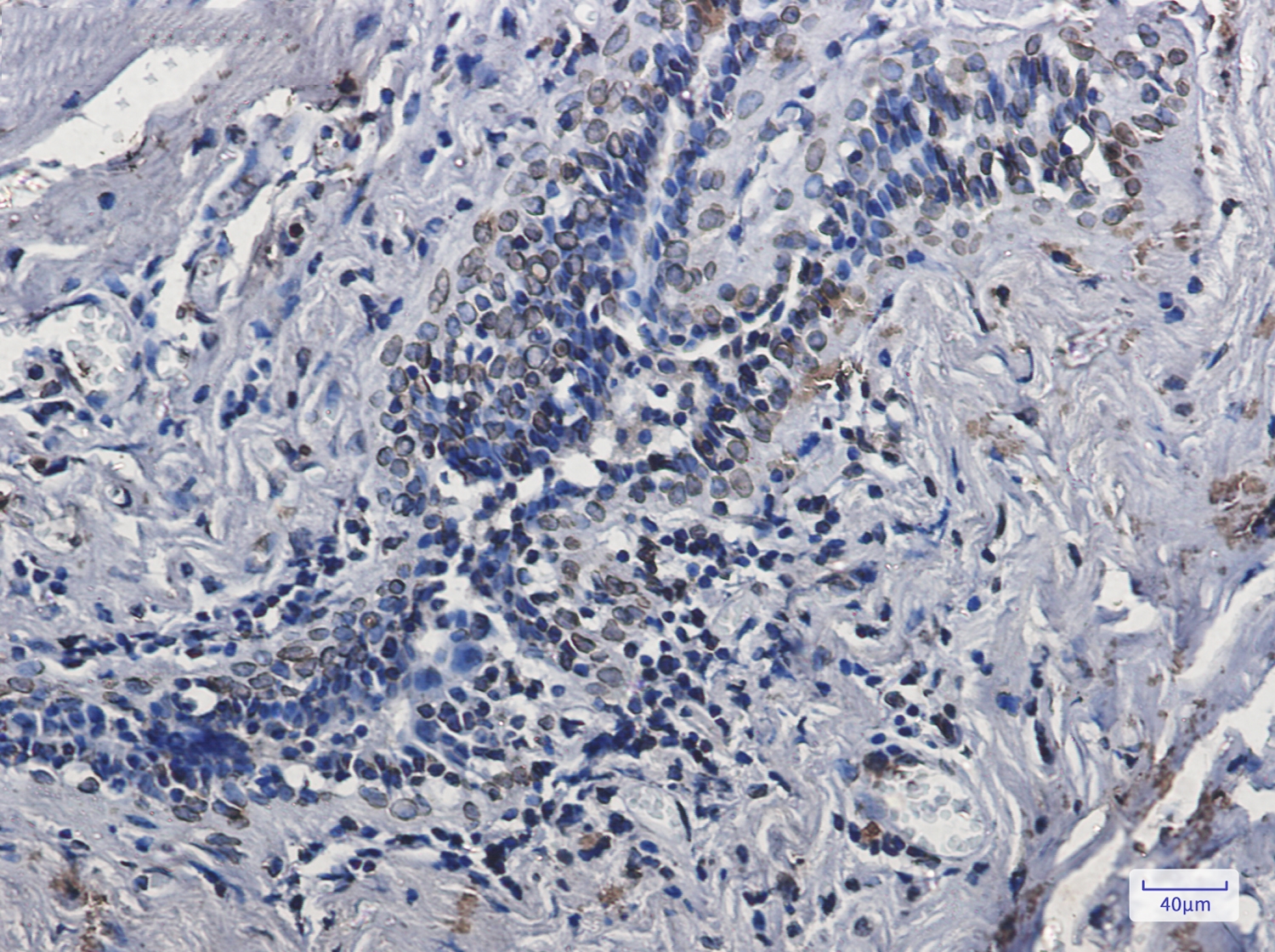 Lamin A/C Rabbit mAb