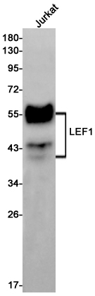 LEF1 Rabbit mAb