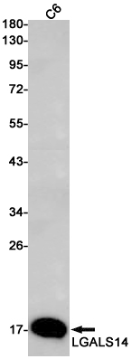 LGALS14 Rabbit mAb