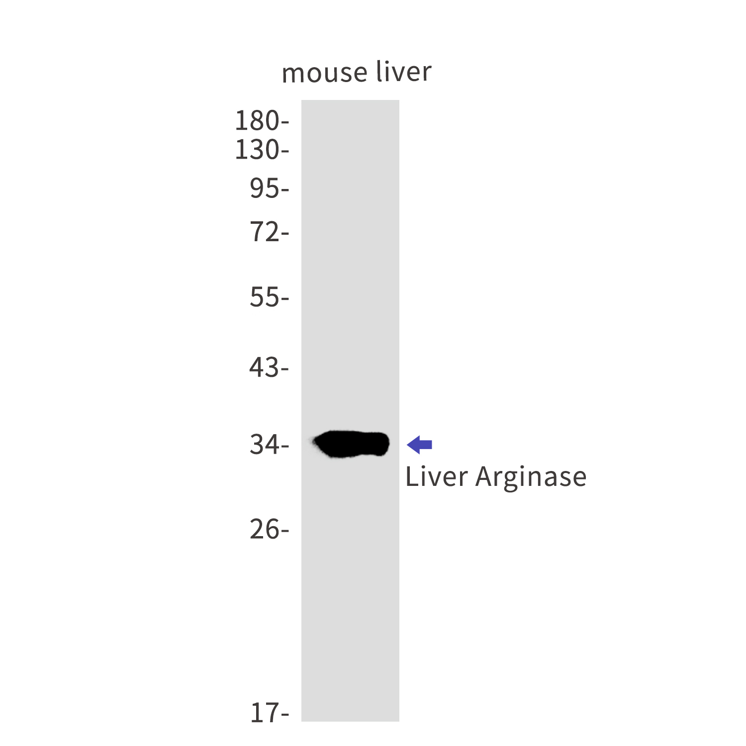 Liver Arginase Rabbit mAb