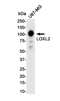 LOXL2 Rabbit mAb