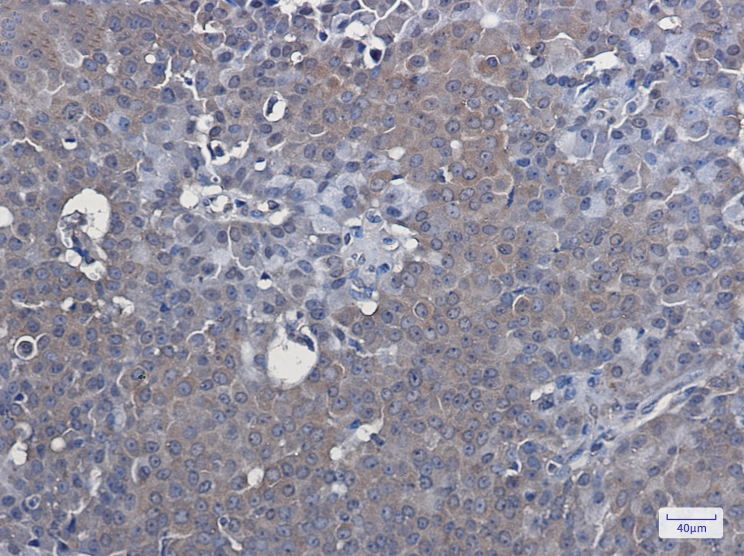 LXR alpha Rabbit mAb