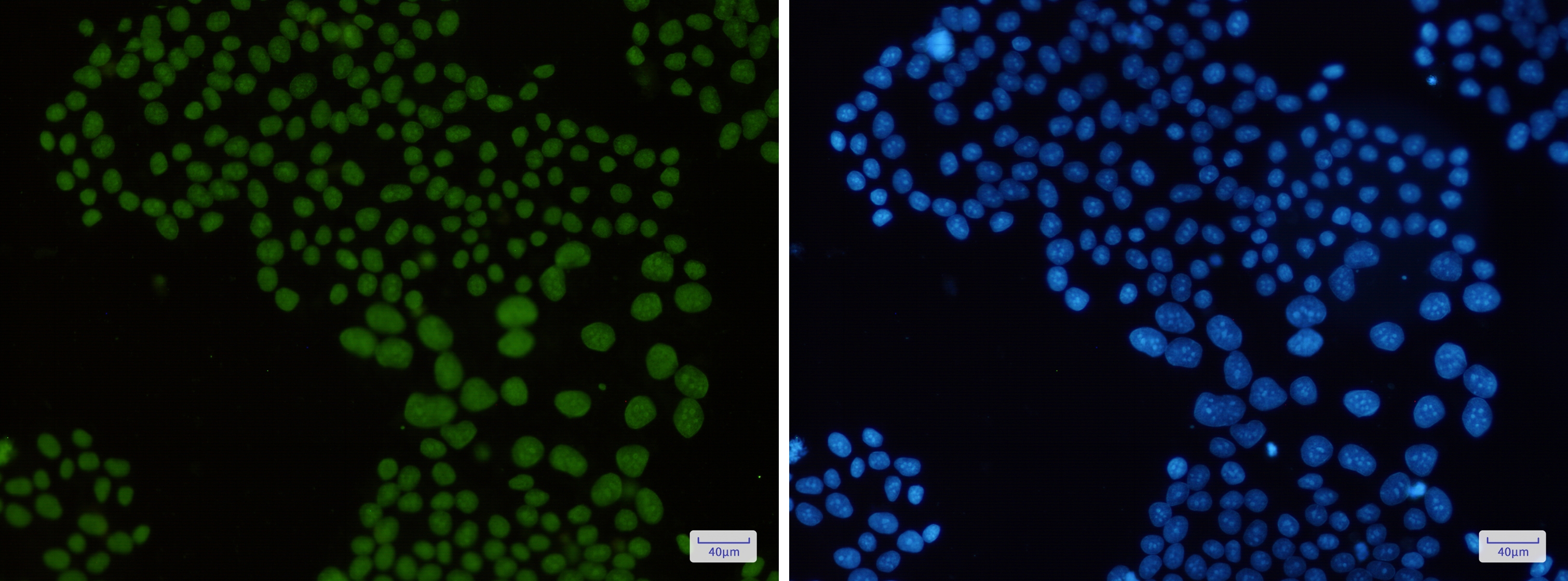 Macro H2A.1 Rabbit mAb