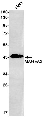 MAGEA3 Rabbit mAb