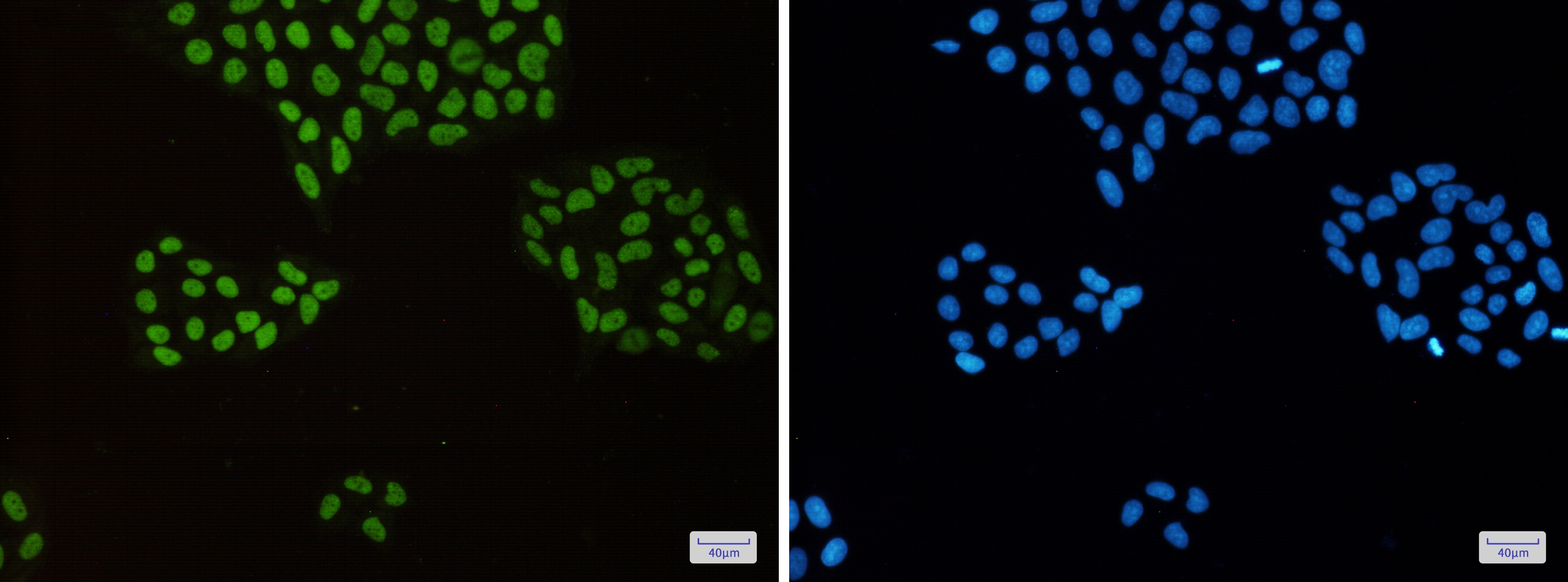 MCM2 Rabbit mAb