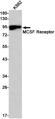 MCSF Receptor Rabbit mAb