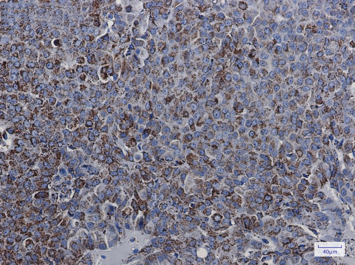 MDH2 Rabbit mAb