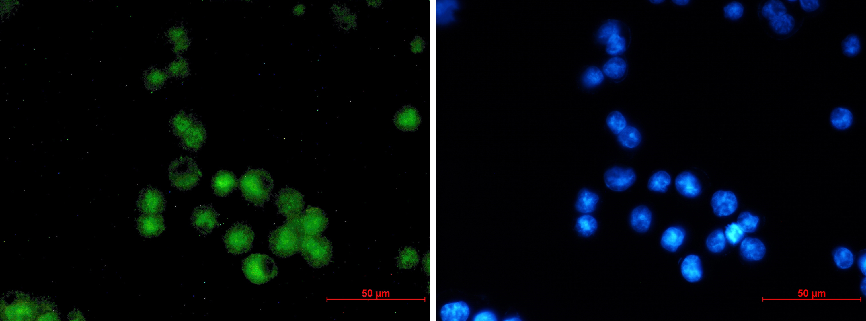 MEF2A Rabbit mAb