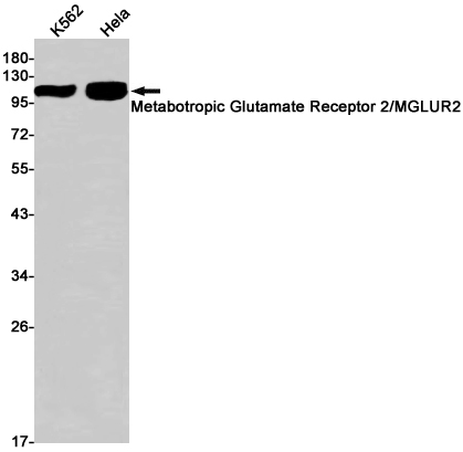 Metabotropic Glutamate Receptor 2 Rabbit mAb