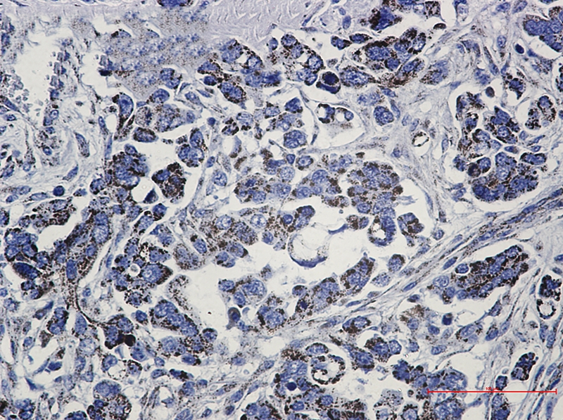 Methylmalonyl Coenzyme A mutase Rabbit mAb